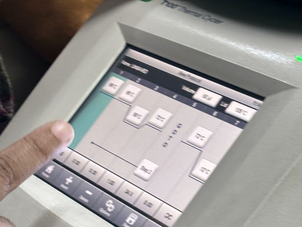 A finger on an instrument touchscreen, mid-protocol.